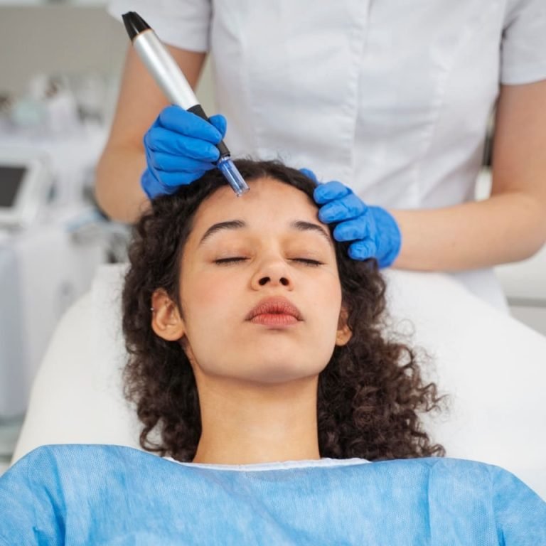 microneedling